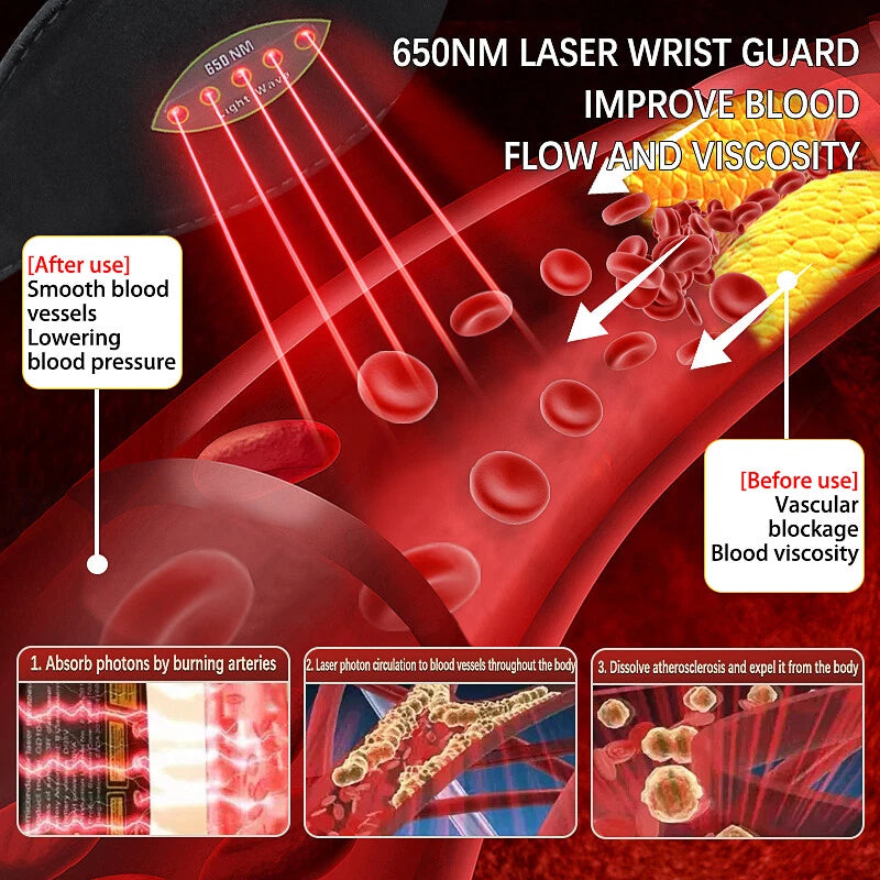 RESUME™ - ÚJ viselhető lézerterápiás vértisztító eszköz, amely javítja a vérkeringést